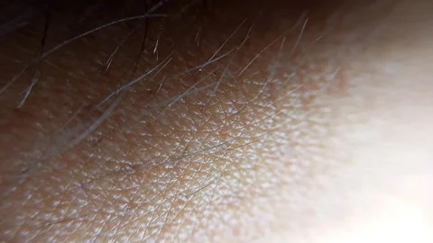 Close up human dry skin Stock Footage 295931756