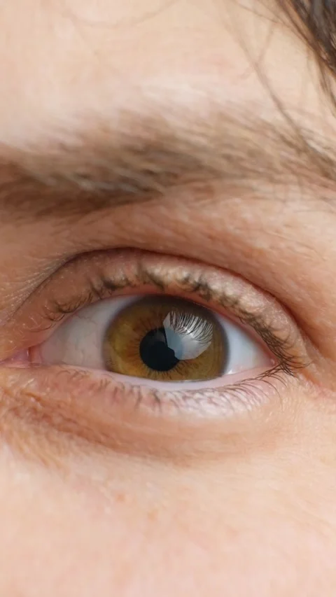 Close-up of human eye with dilated pupil after medical eye drops Stock Footage 337701958