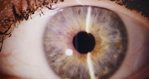 Close-Up of Human Eye During Eye Examination Stock Footage 310802795