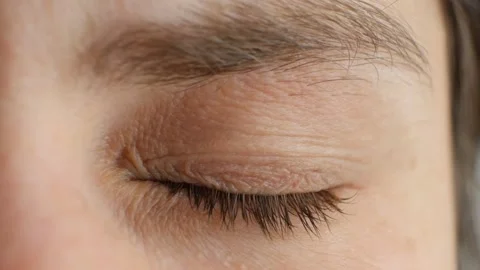 Close-up of a human eye with heavily dilated pupil Stock Footage 337701942