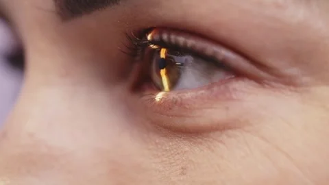 Close-up of a human eye illuminated by a narrow beam of light from a slit lamp, Stock Footage 337285878