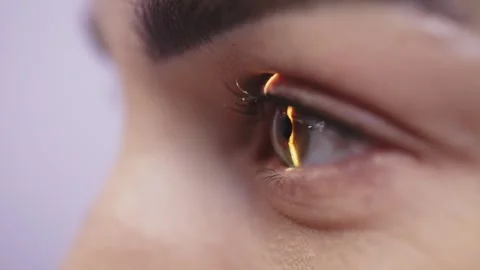 Close-up of a human eye illuminated by a narrow beam of light from a slit lamp, Stock Footage 337286107