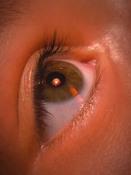 Close-Up of Human Eye with Reflection Stock Photos