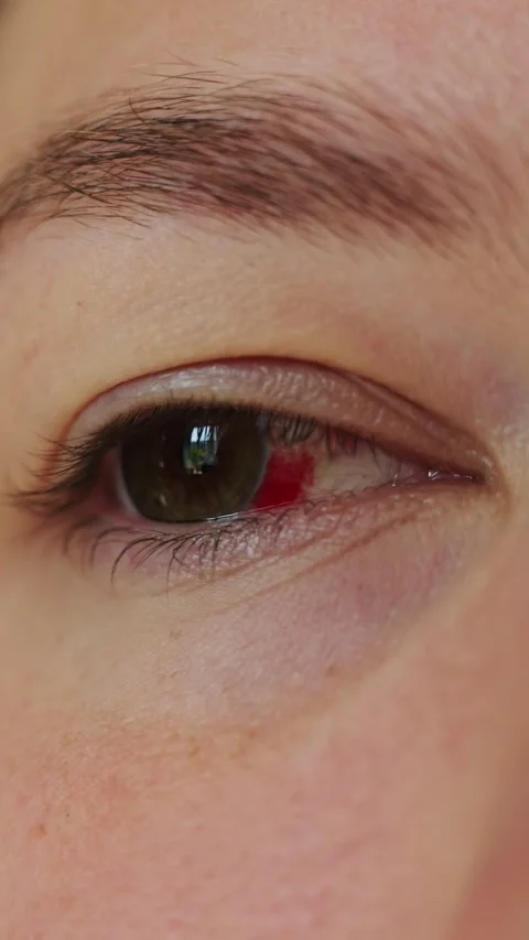 Close-up of human eye showing blood vessels and iris detail Stock Footage 340261162