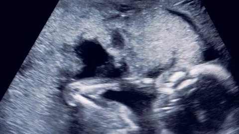 Close up of human fetus rolling over in mother's womb Stock Footage 88526812