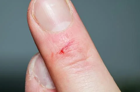 Close-up of human finger with small cut and a drop of blood against dark back Стоковые фото