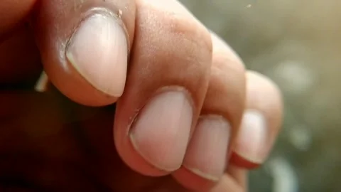 Close-Up of Human Fingernails on Hand Stock Footage 339263290