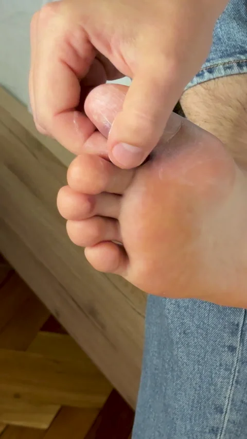 Close-up of a human hand applying a bandage to an inflamed and bruised toe Video stock 335524724