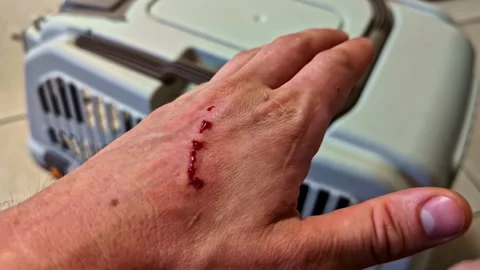 Close-up of human hand with deep fresh scratch with angry cat in plastic pet Vidéo 313858366