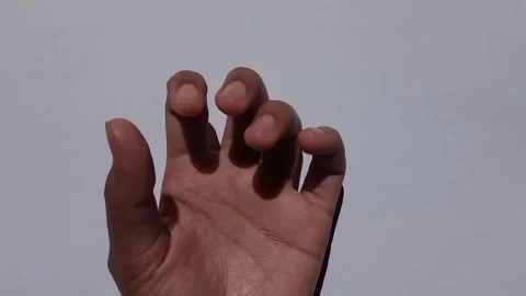 Close-up of a human hand repeatedly opening and closing against Stock Footage 311597960