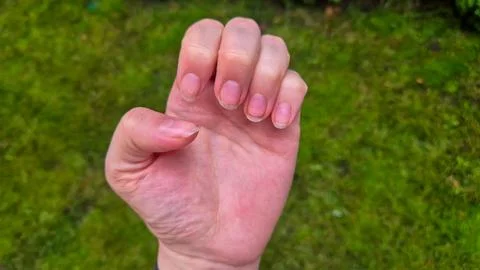 Close-up of a human hand with visibly unclean fingernails held against a blurred Stock-Fotos