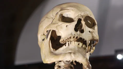 Close-up of the human skull. Stock Footage 239631258