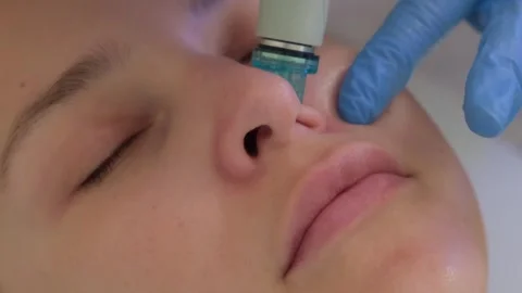 Close-up hydro peeling procedure for beautiful woman in cosmetology clinic. Vídeos de archivo 250169833