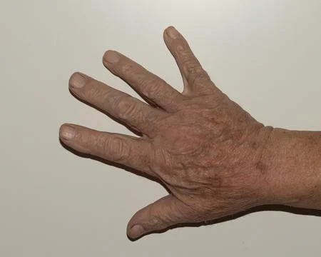 Close-up image of an elderly hand fully open with all five fingers extended.. Foto stock