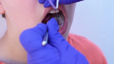 Close up image showing a dentist's hands inspecting a child's teeth and mouth. Stock Footage 332777393