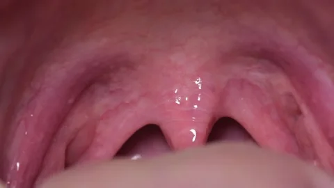 Close to the inside of the human mouth. Stock Footage 155866447