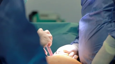 Close up of installing laparoscopy camera surgery robot in surgical room in h 動画素材 102186289