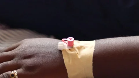 CLose up of an Iv line installed on a patient's hand Stock-Footage 172001516