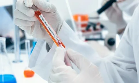 Close up. lab technician making a mark on the tube with the test. Foto stock
