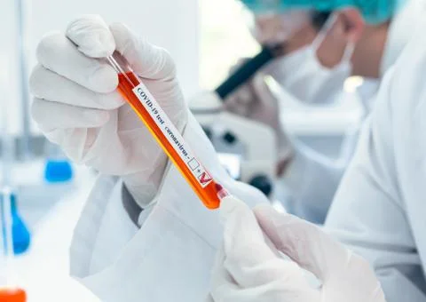 Close up. lab technician making a mark on the tube with the test. Foto stock