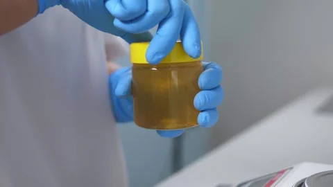 Close-up of a laboratory assistant opens honey for analysis and quality control. Stock Footage 288333430