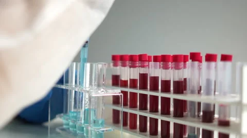 Close-up of laboratory assistants hands in protective gloves working with blood Stock Footage 131551165