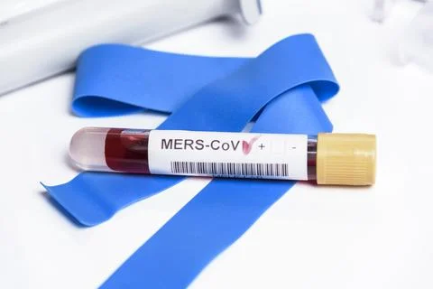 Close-up of laboratory sample positive for MERS-CoV infection. Stock Photos
