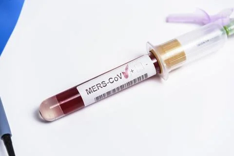 Close-up of laboratory sample positive for MERS-CoV infection. Stock Photos