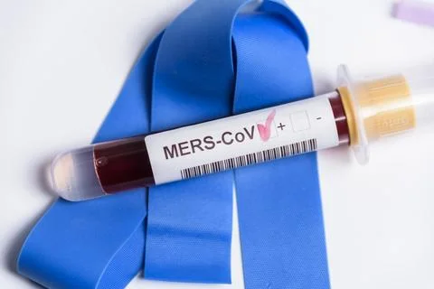 Close-up of laboratory sample positive for MERS-CoV infection. Stock Photos
