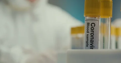 Close-up laboratory scientist laboratory assistant gloves test tubes virus Stock Footage 128121641