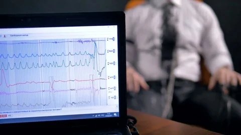 Close-up of the laptop and the man connected to the lie detector circuit. Stock Footage 77119389