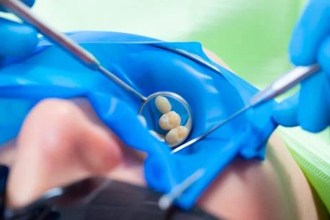 Close-up latex plate designed to isolate the tooth to be treated from the rest Stock Photos