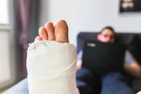 Close-up on a leg in a cast Stock Photos