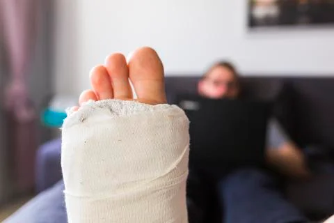 Close-up on a leg in a cast Stock Photos