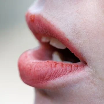 Close-up of lips slightly parted Stock Photos