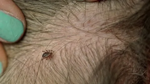 Close-Up of a Live Tick Being Found on a Dog's Bod Stock Footage 231216474