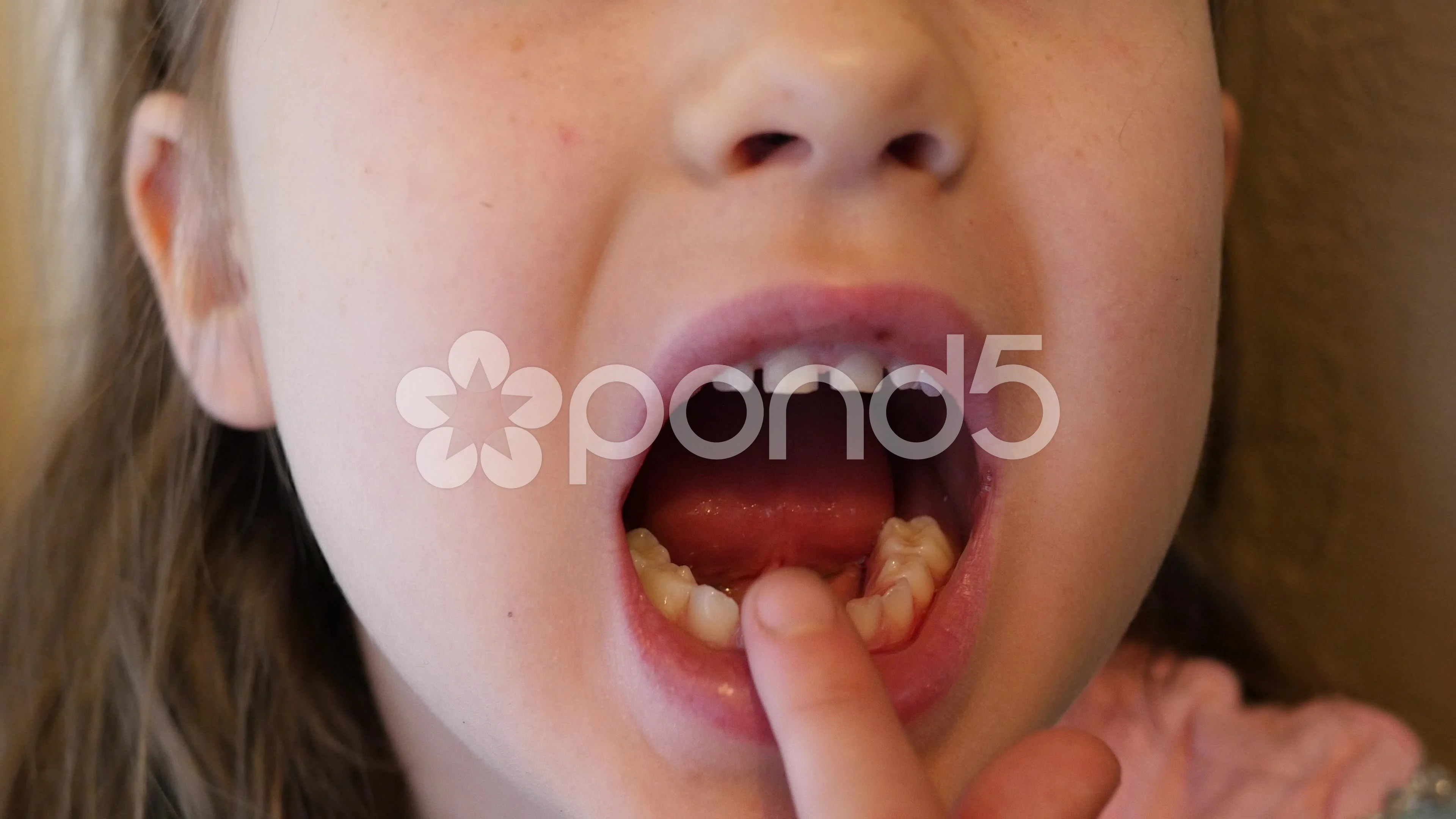 Close up of Loose Tooth Stock Video Pond5