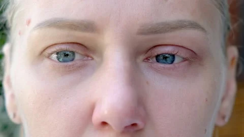 Close-up of macro shot of sad blue eyes. Young beautiful blonde looks into Vídeo Stock 218580051