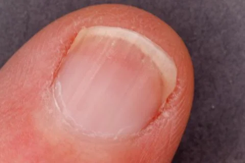 Close-up macro showing human finger nail health Stock Photos