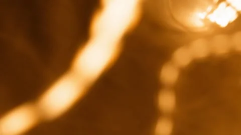 Close up macro view representing movement of intestinal parasites inside huma Video stock 327614288