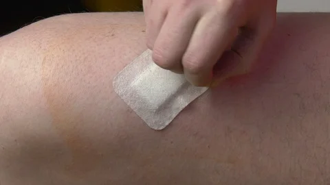 Close-up of a male hand removes a patch from a leg operation site. Stock Footage 120263231