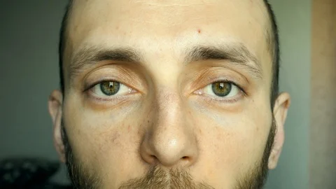 A close-up man can only move one eye Stock Footage 127185448