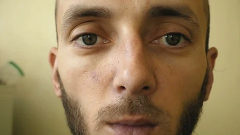 A close-up man can only move one eye Stock Footage 127185821