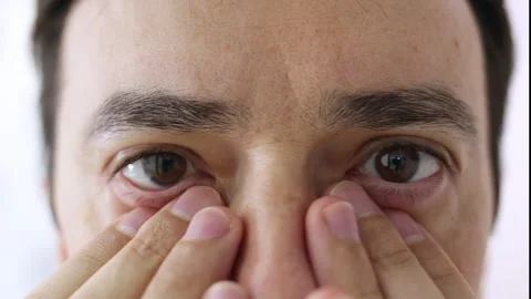 Close up of man checking his eyes for irritation Stock Footage 344278458