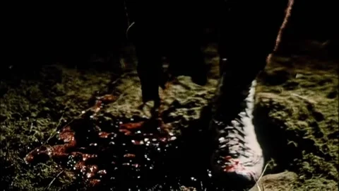 Close-up man with missing foot bleeding on grass Stock Footage 260248559