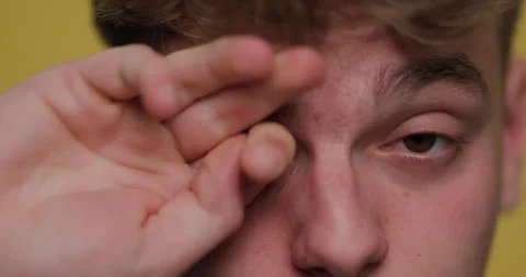 Close-up of a man rubbing his eye while experiencing fatigue in a bright yellow Video stock 346665811