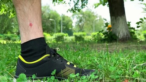 Close up. A man scratches a mosquito bite on his leg Video stock 133137919