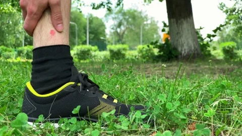 Close up. A man scratches a mosquito bite on his leg 스톡 동영상 133137992