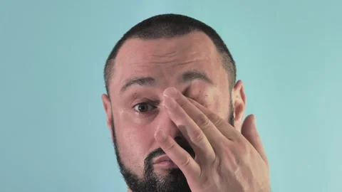 Close-up of a man scratching his eye Video stock 243669283