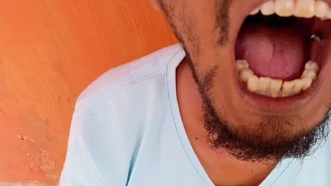 Close-up of a man showing his teeth with noticeable stains. Stock Footage 321930056